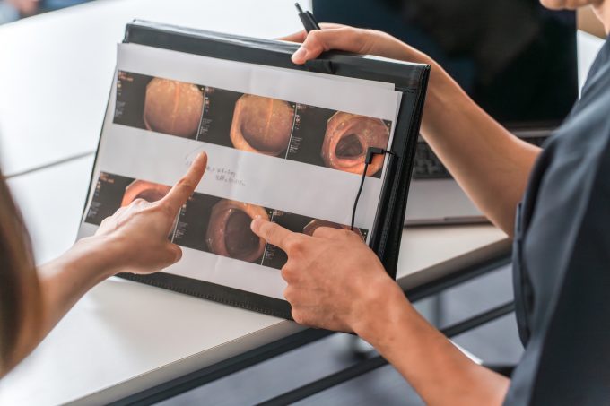 消化器内科の検査結果説明